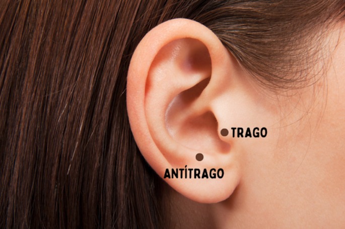 Saliências acima do lóbulo representando o trago e o antítrago